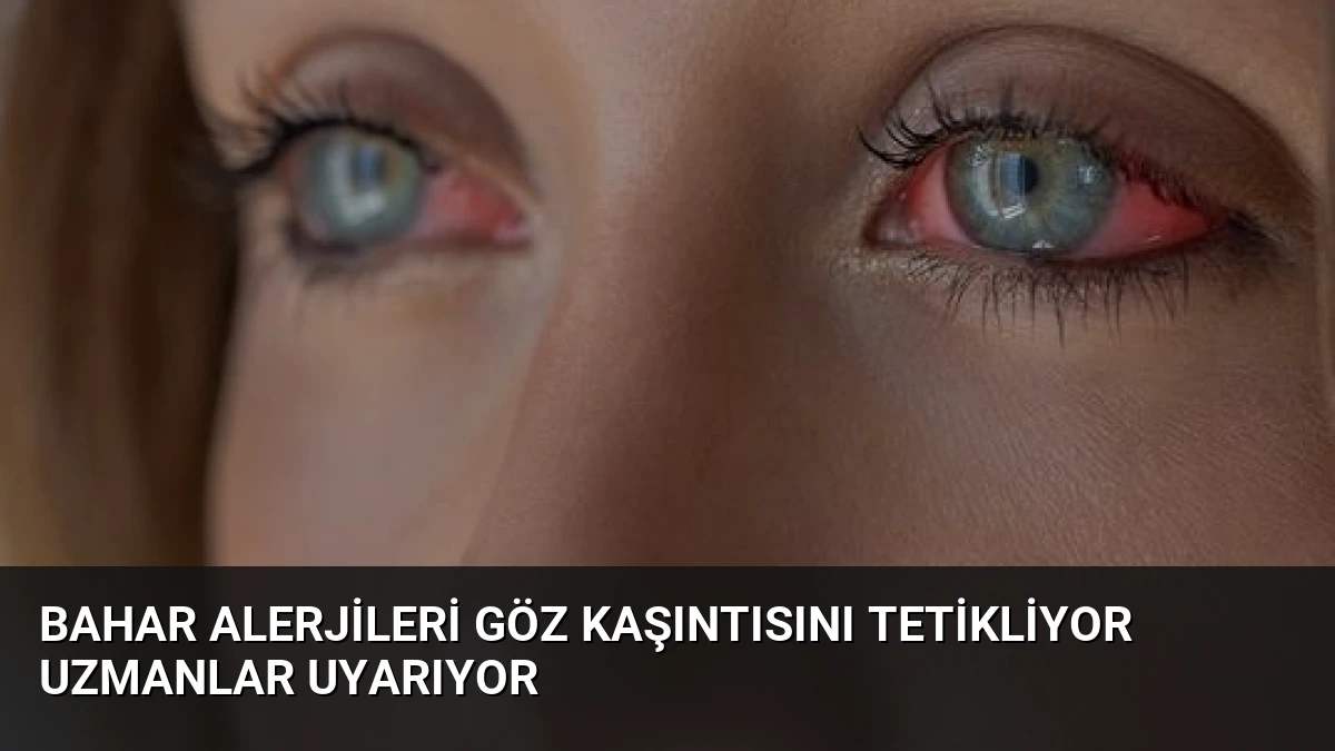 Bahar Alerjileri Göz Kaşıntısını Tetikliyor Uzmanlar Uyarıyor