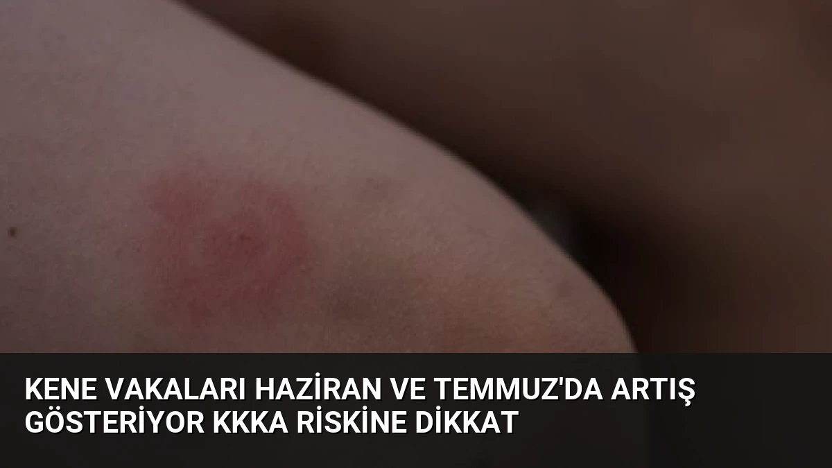 Kene Vakaları Haziran ve Temmuz’da Artış Gösteriyor KKKA Riskine Dikkat